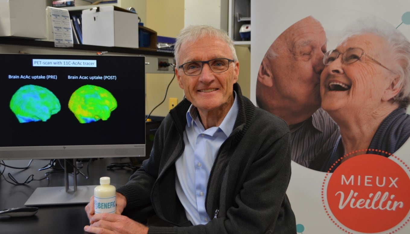 Ketogenic drink boosts brain in cognitively impaired, says Nestlé study  