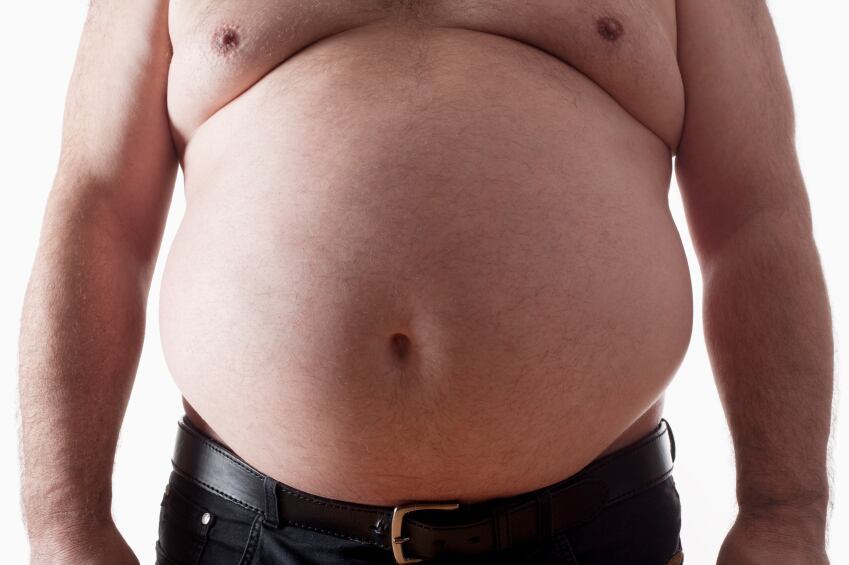 obesity-fat-weight-obese-abdominal.jpg