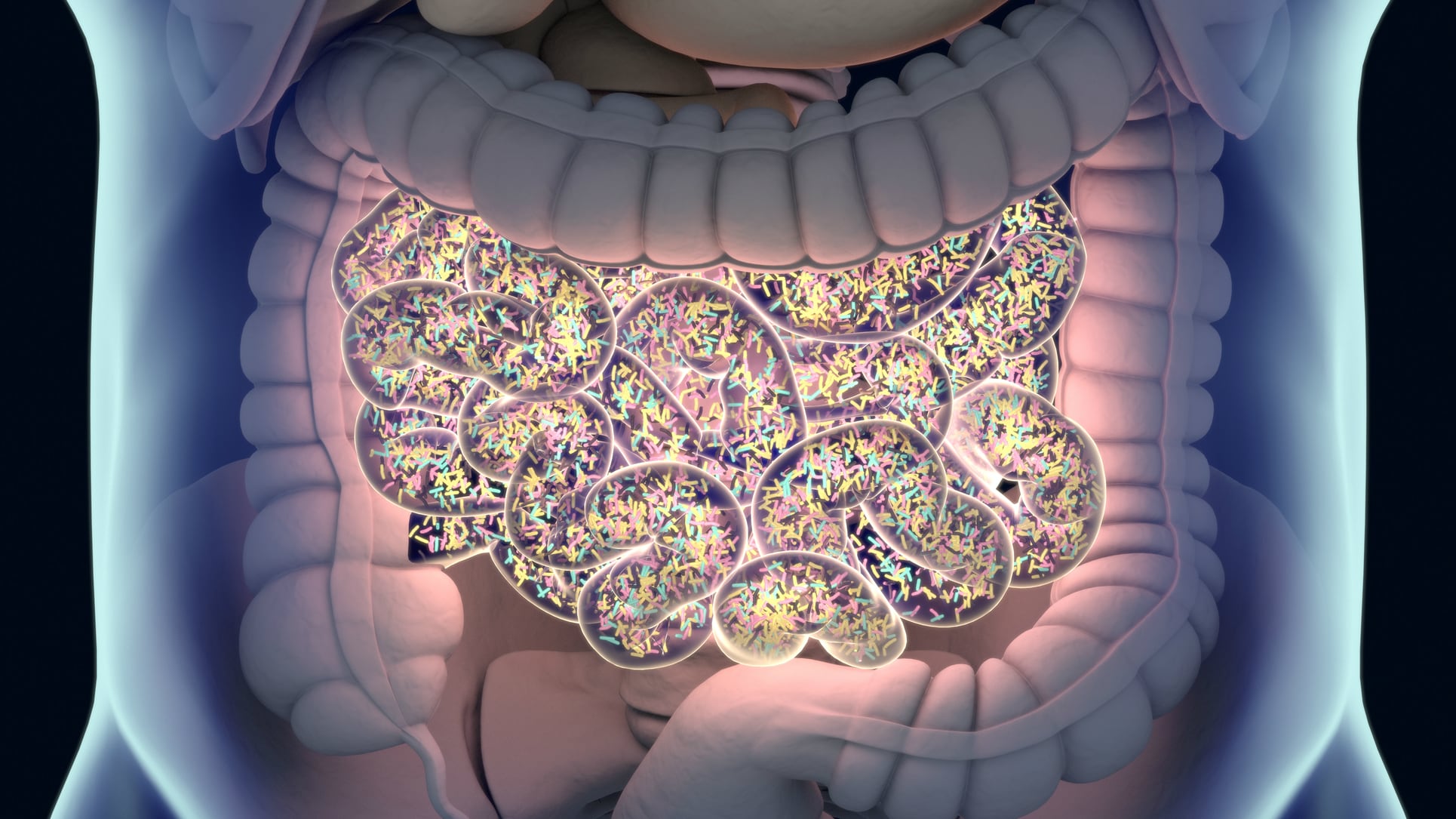 Carcinoma-fighting combination: Probiotic blend may alleviate oral mucositis during radiochemotherapy