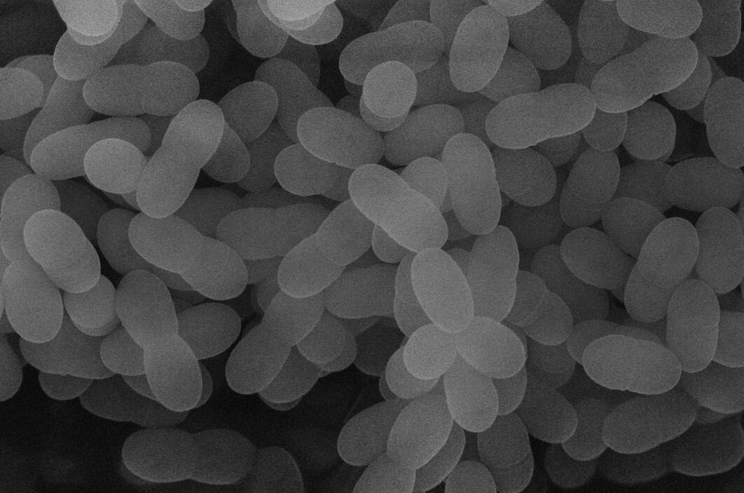 Nagasaki University and Kirin to study lactic acid bacteria on relieving symptoms in COVID-19 patients