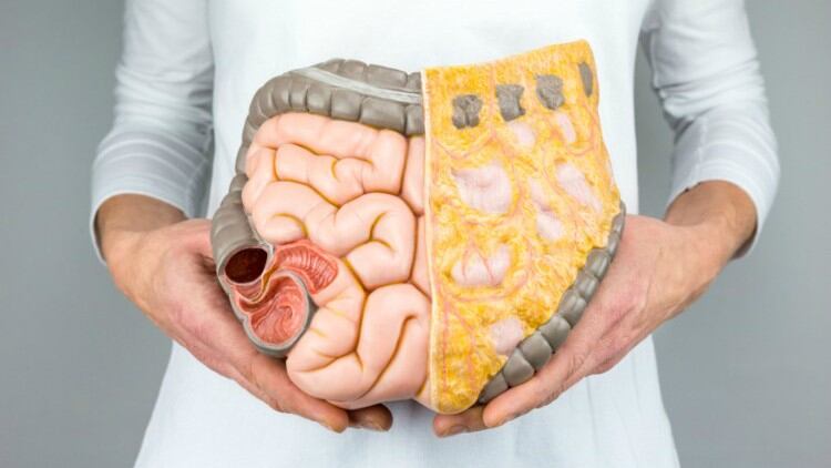Commercialisation on the cards after Australian faecal microbiota transplantations show ulcerative colitis benefits