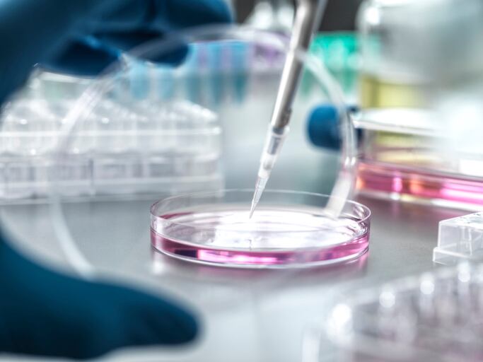 Scientist pipetting medical samples into petri dish in laboratory.