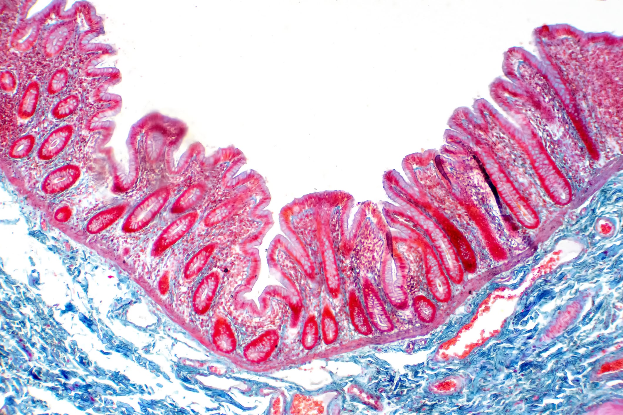 ‘The gut microbiota is not the key to health—it’s the gut barrier,’ says microbiologist