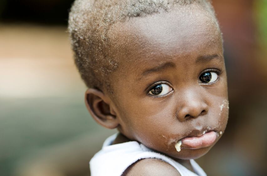 Malnutrition progress ‘too slow’ as Africa and Asia shoulder burden, says UN report 