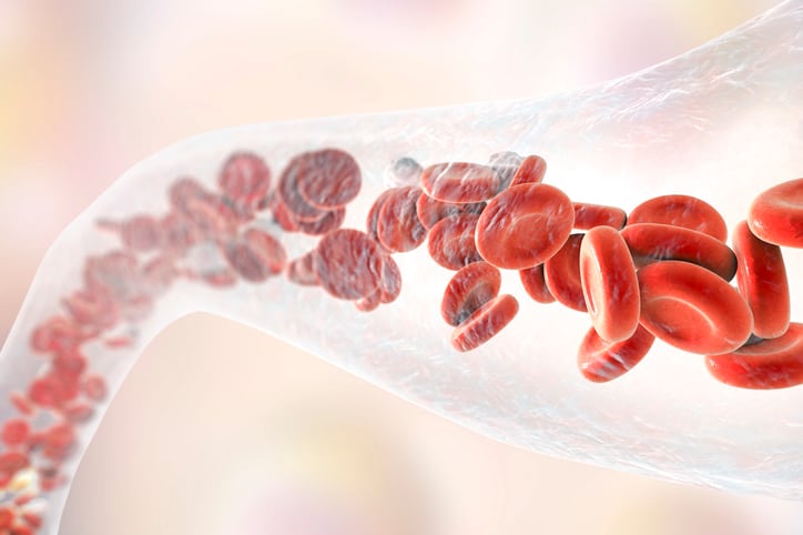 Study finds key role for vitamin K2 in forestalling development of aneurysms