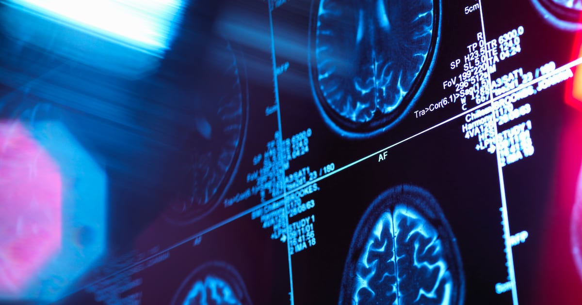 Magtein wins NI Award for brain health research innovation
