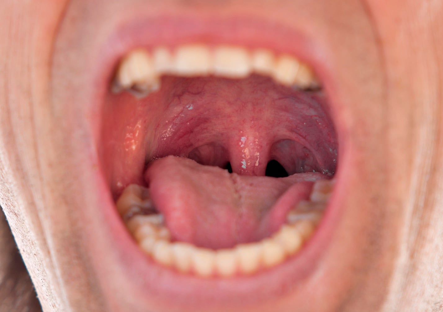 Study-identifies-new-oral-probiotic-candidate.jpg