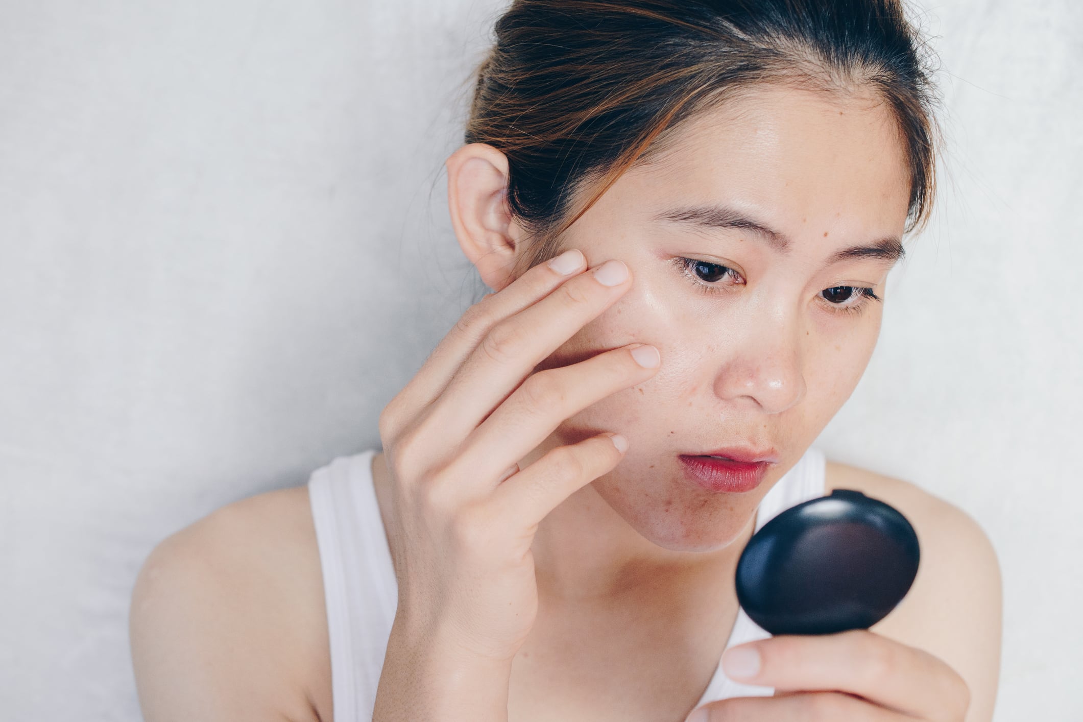 Fighting Asian flush: Study finds brimonidine gel effective in reducing facial redness
