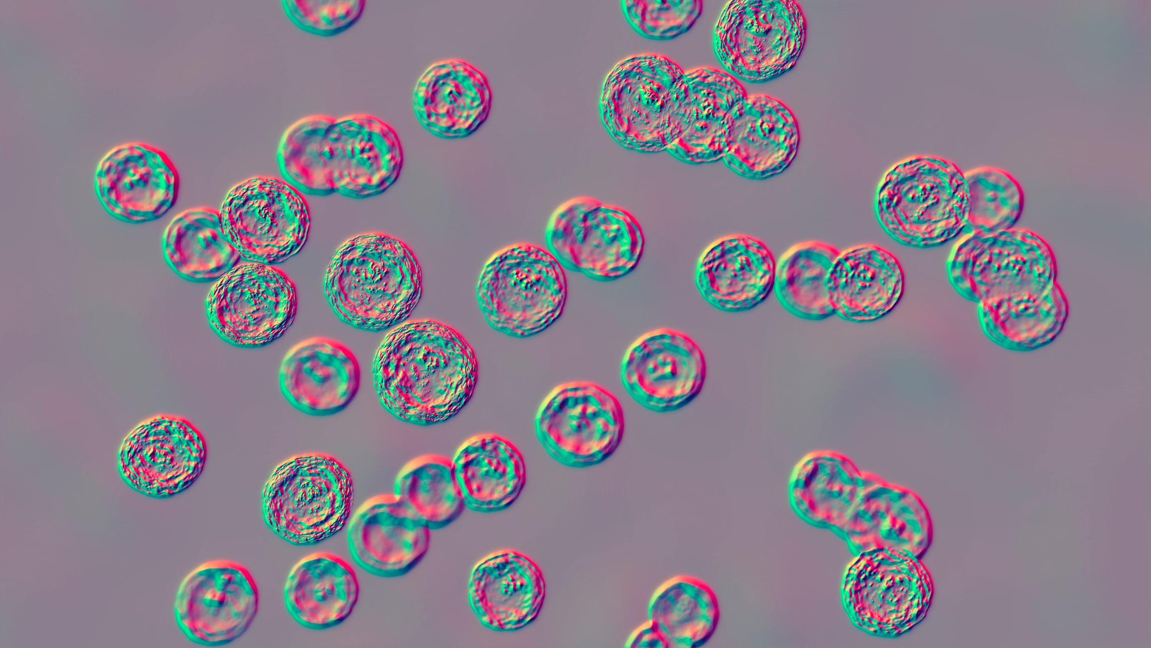 Pediococcus bacteria, computer illustration. These are Gram-positive cocci, associated with infections in patients with gastrointestinal abnormalities, after abdominal surgery, cause bacteremia, abscess, meningitis and infections of other locations. Also, they are lactic acid bacteria used in production of sauerkraut, sausages, cheeses and yogurts.