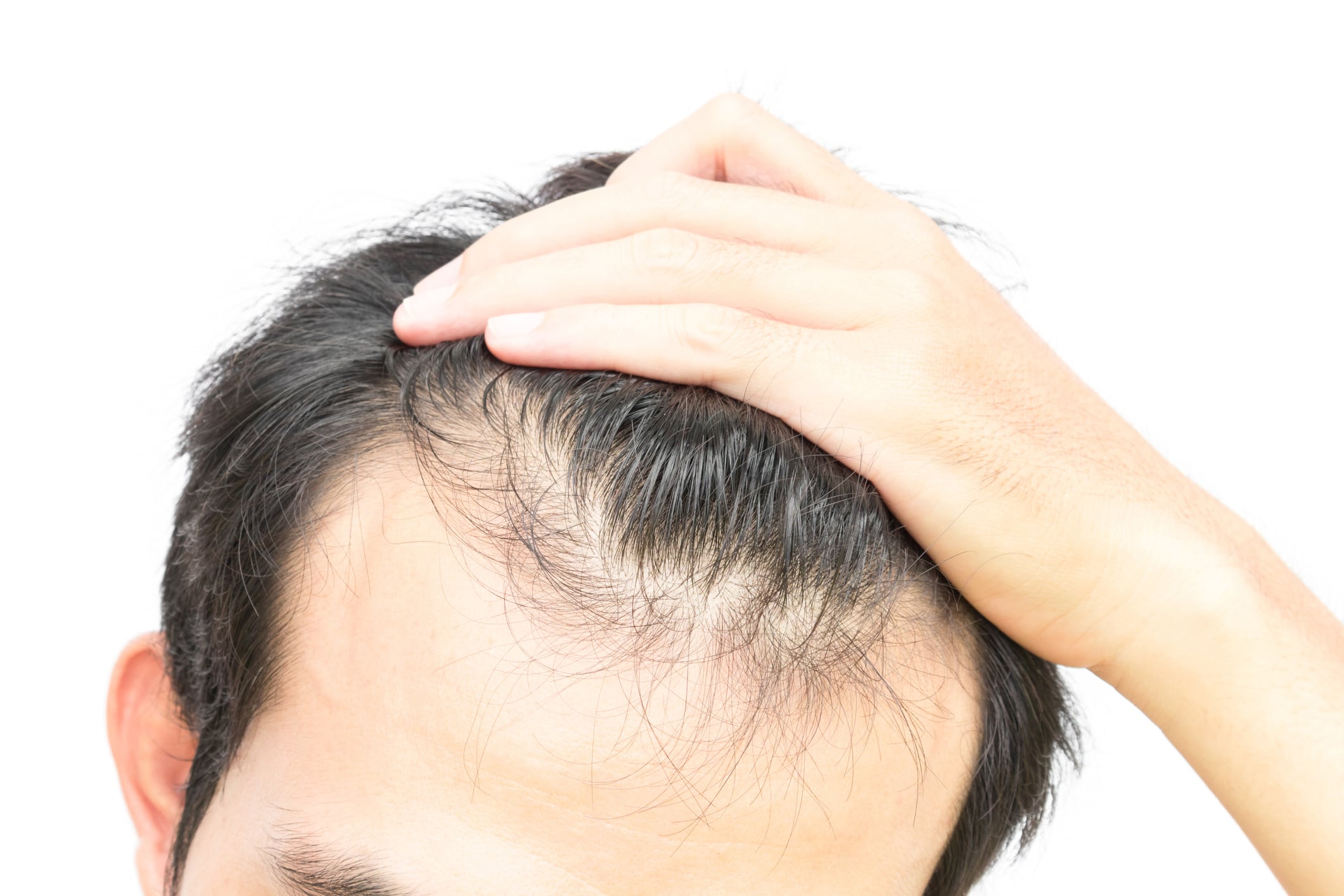 Powerful native trees: US firm files patent on açaí-pink lapacho blend for hair growth