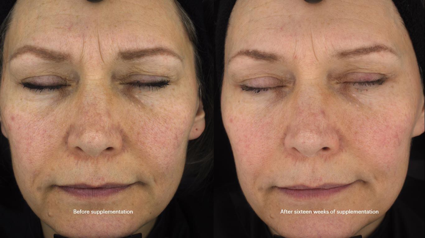 Lycoderm-study.jpg