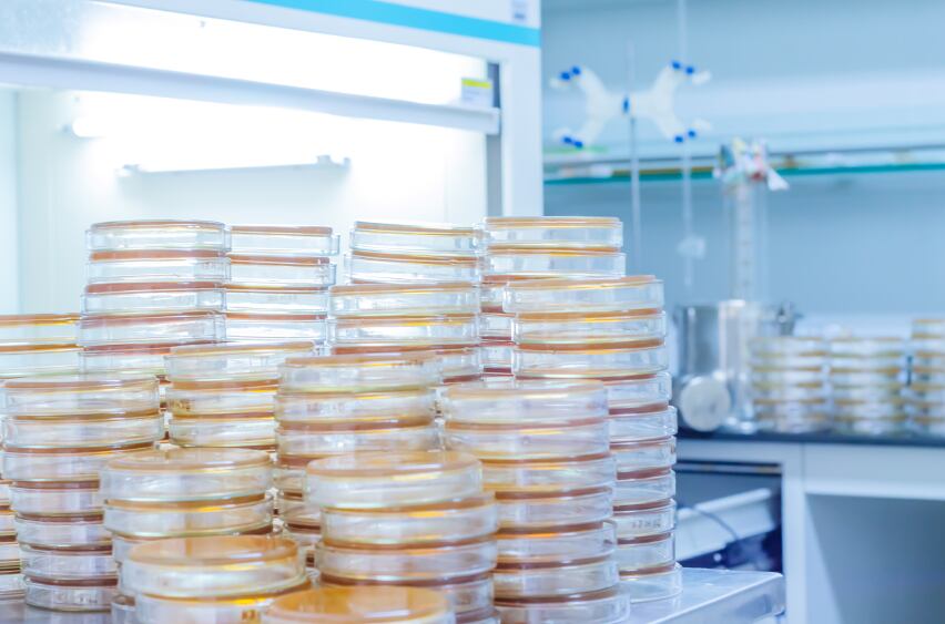 probiotics-lactobacillus-petridishes-lab-science.jpg