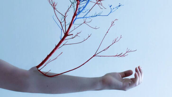 Horphag-study-expands-Pycnogenol-use-for-spider-veins-post-surgery.jpg