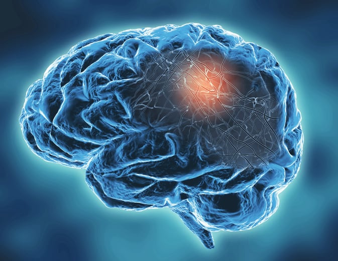 Oxidative-stress-and-gut-microbiota-s-role-in-neurodegeneration-Review.jpg