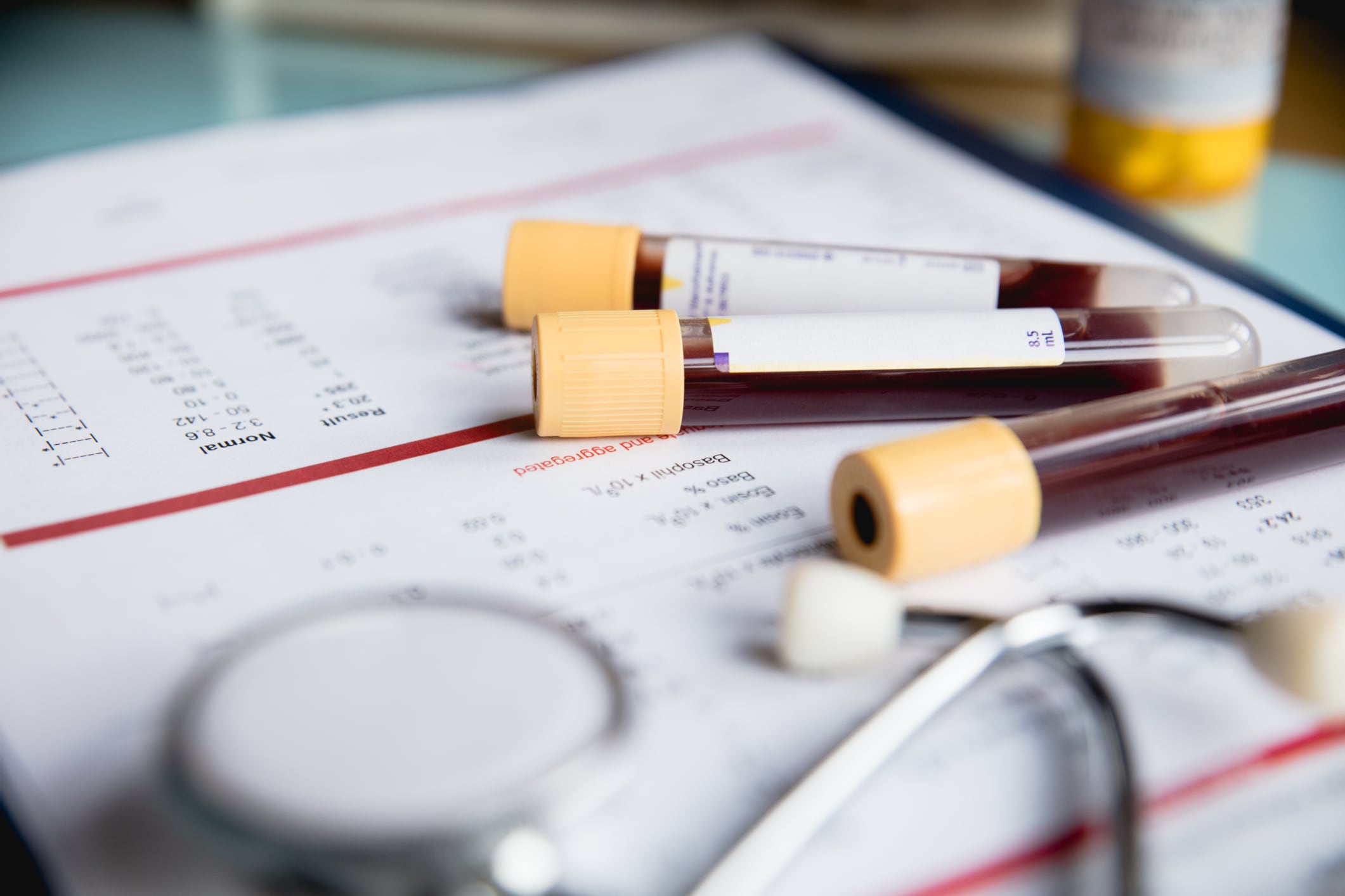 Researchers create accurate blood test to track fatty acid intake