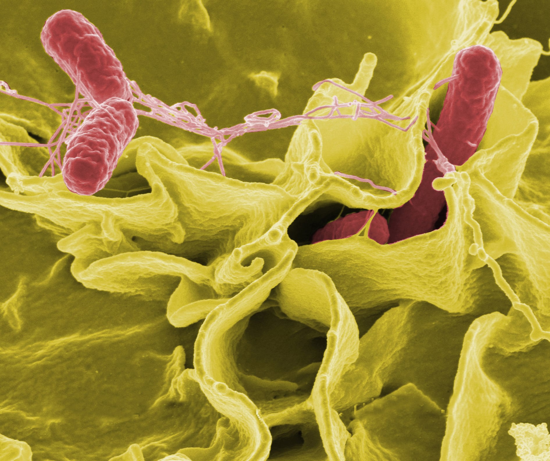 SEM of Salmonella typhimurium (red) invading cultured human cells