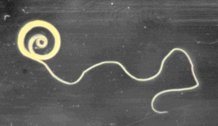 EFSA cites safety issues over whipworm egg use as immune-boosting supplement