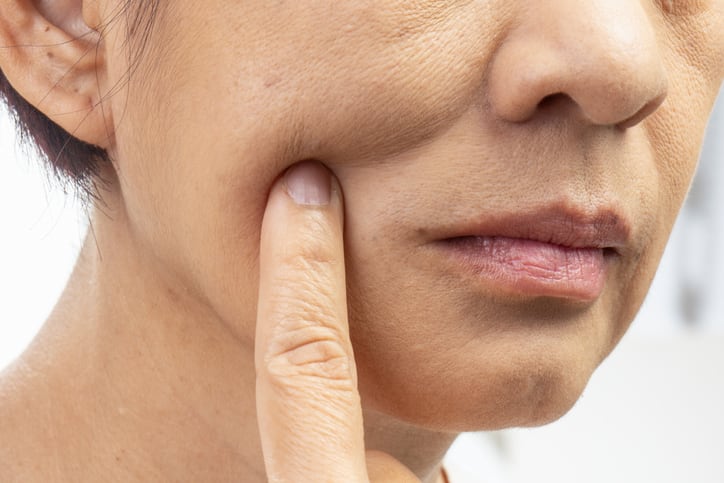 How GLP-1 users can support their skin amid weight loss