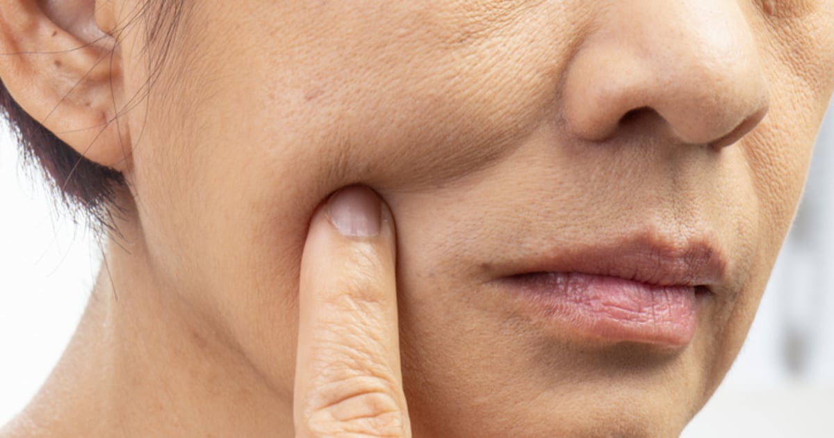 Glp Rash How GLP-1 users can support their skin amid weight loss
