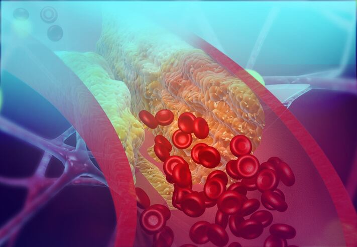 Danish population study further bolsters case for vitamin K2