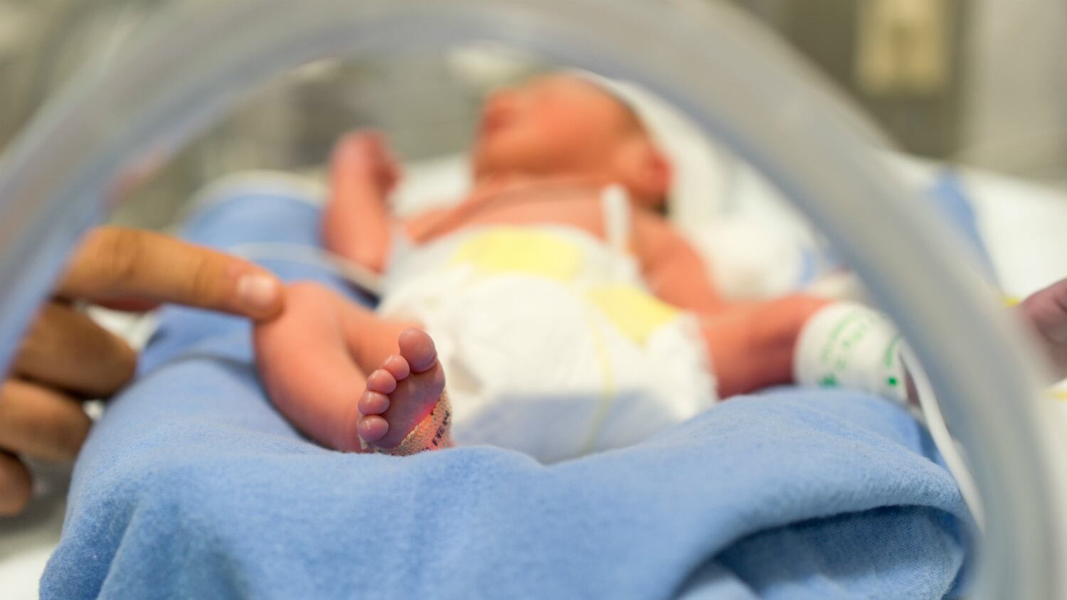 Probiotic supplementation may protect premature infants from NEC: Australian population study
