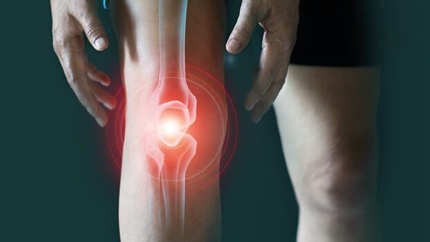 Krill oil’s beneficial effect on joint health recognised on the Australian Register of Therapeutic Goods (ARTG) as ‘assessed listed’ medicine