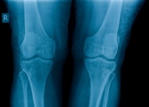 Knees - Joint Health