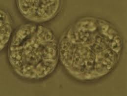 Photomicrograph of the micro-algae Schizochytrium courtesy