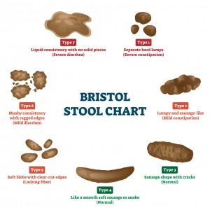 Bristol Stool Scale © VectorMine Getty Images
