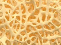 Osteoporosis bone mineral density