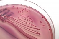 E.coli agar plate