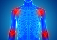 inflammation joints bone iStock.com goa_novi