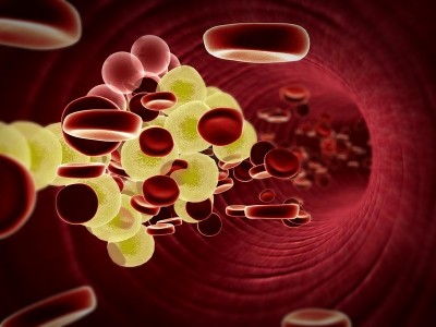Pharmena says 1-Methylnicotinamide chloride (1-MNA) could be used to reduce risk factors of atherosclerosis – whereby plaque builds up inside the arteries. ©iStock/Ugreen