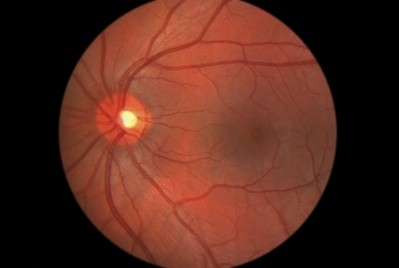 The macula is a yellow spot of about five millimeters diameter on the retina