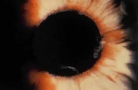 Folate & glaucoma: 