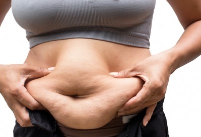 Rising obesity rates and ineffective weight management strategies have increased the prevalence of bariatric surgeries to treat morbid obesity. ©iStock