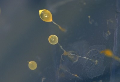 The unicellular amoeba Dictyostelium discoideum can form a multicellular association and build fruiting bodies that release spores. Source: Falk Hillmann/Leibniz-HKI