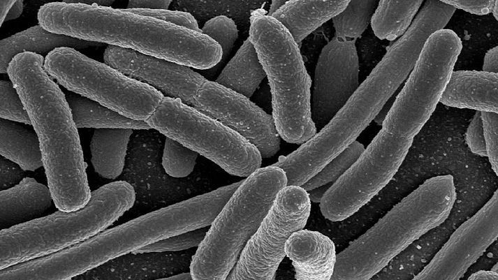 Gut microbes may have role in autoimmune protection
