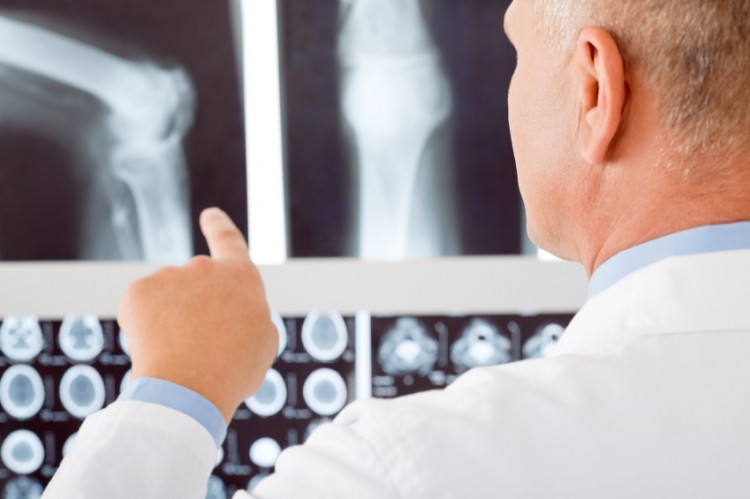 EGCG may well form a natural alternative to current drugs used to treat rheumatoid arthritis. © iStock.com