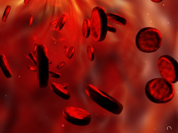 A new needle-free method uses an optical fibre on the lip to detect the fluorescence of red blood cell zinc protoporphyrin, a compound found in red blood cells when heme production is inhibited. © iStock.com