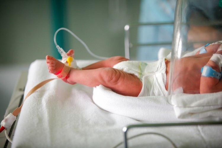 Premature births, which are births before 37 weeks of gestation, are the leading cause of death in Australian children. GettyImages