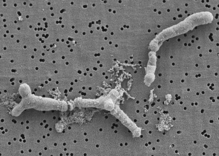 Electronic microscopy image of B. longum KABP042 strain. ©AB-Biotics