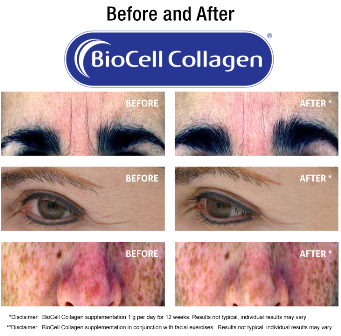 BioCell publishes study demonstrating anti-aging advantages of collagen supplement