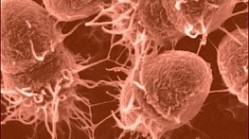 Alterations to gut microflora could help to battle obesity, suggest researchers from INRA in France.
